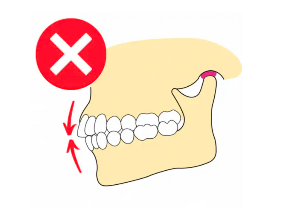 Image illustrating 'Mewing Tongue Posture', demonstrating correct tongue alignment against the palate to enhance facial structure and oral health-2