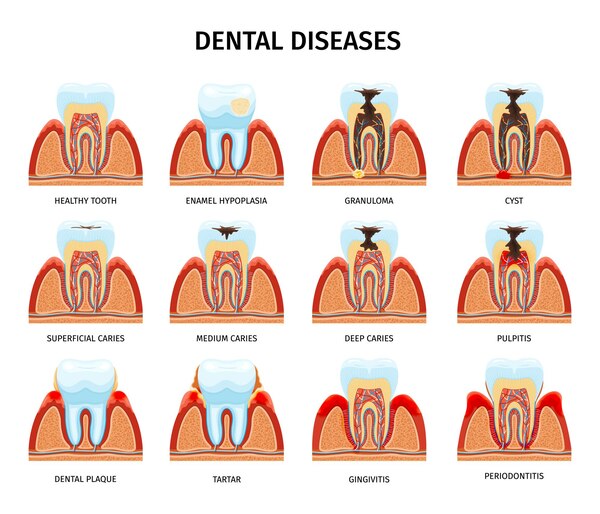 dental-cap