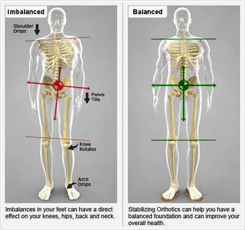 Importance of proper alignment - correctly developed foot arches support the whole body posture.