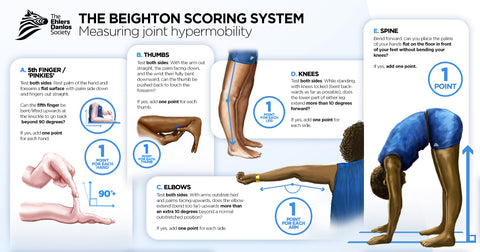 How to measure the joints hypermobility