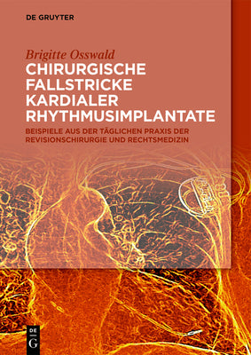 Chirurgische Fallstricke kardialer Rhythmusimplantate: Beispiele aus der tglichen Praxis der Revisionschirurgie und Rechtsmedizin (German Edition)