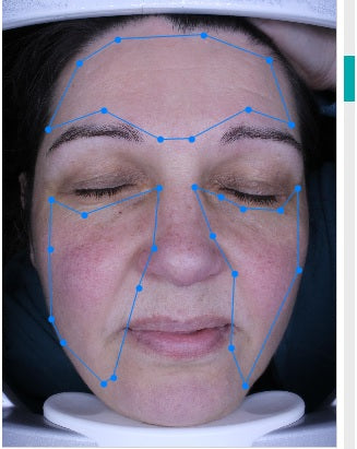 3 regions of interest (ROIs) for frontal images