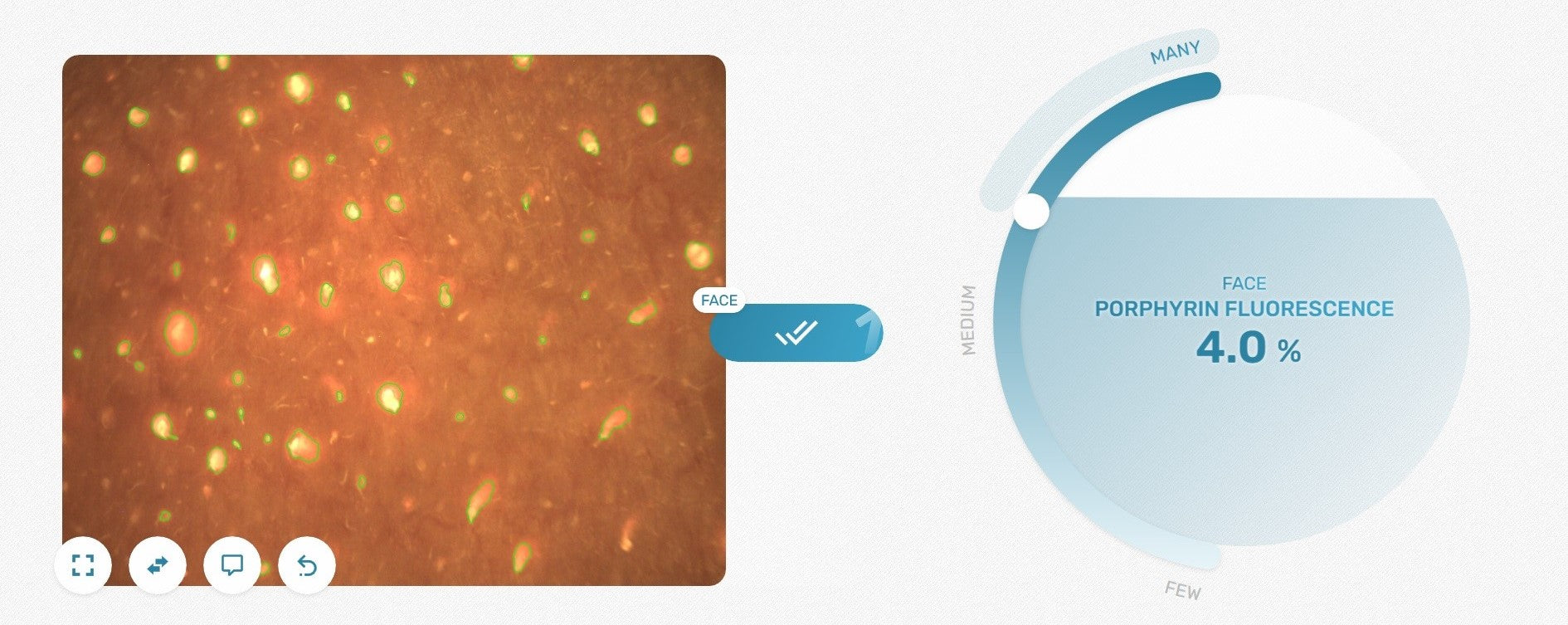 Impressive visualization of porhyrine fluorescence