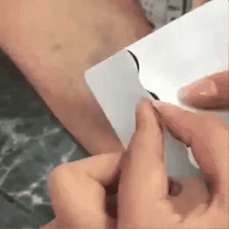 Parches para Varices Pack 2 x24 Unidades – Winner CHILE