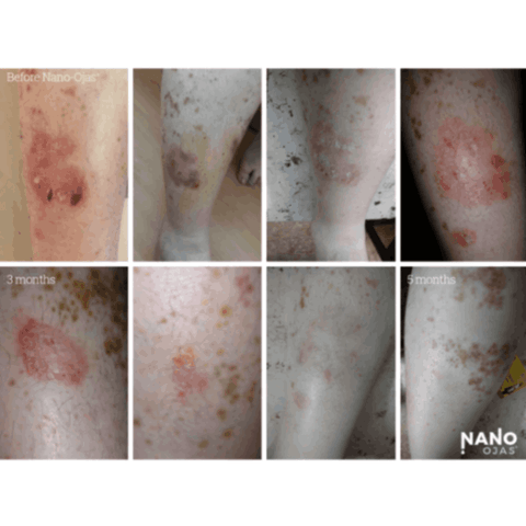 before and after repair for skin conditions