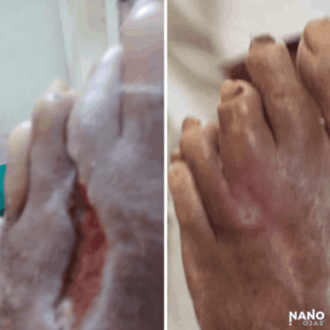 natural wound care before and after
