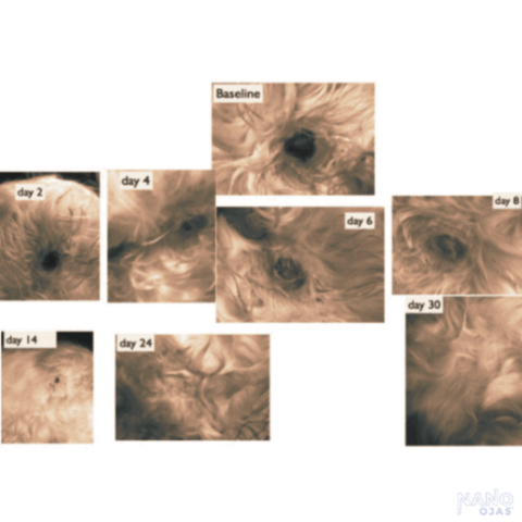 before and after nano-ojas metadichol