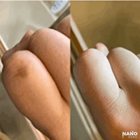 natural burn relief before and after