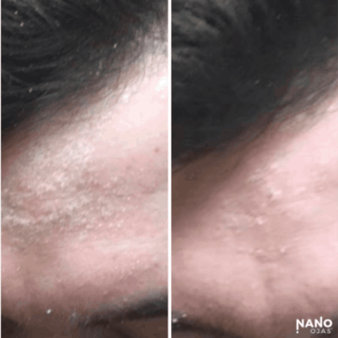 before and after homeopathic skin remedy