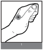 Hand Acupuncture Point