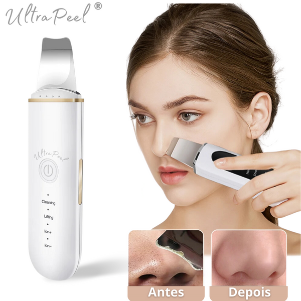 Removedor de cravos, aparelho limpeza de pele, Peeling Facial Ultrassônico, Peeling Ultrassónico Facial Portátil, Peeling Ultrassônico Portátil Removedor de Cravos, Peeling Ultrassônico Portátil para Limpeza de Pele e Removedor de Cravos, Aparelho Peeling Ultrassônico Portátil Limpeza de Pele – UltraPeel