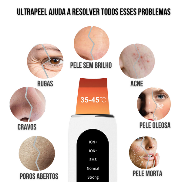 Removedor de cravos, aparelho limpeza de pele, Peeling Facial Ultrassônico, Peeling Ultrassónico Facial Portátil, Peeling Ultrassônico Portátil Removedor de Cravos, Peeling Ultrassônico Portátil para Limpeza de Pele e Removedor de Cravos, Aparelho Peeling Ultrassônico Portátil Limpeza de Pele – UltraPeel