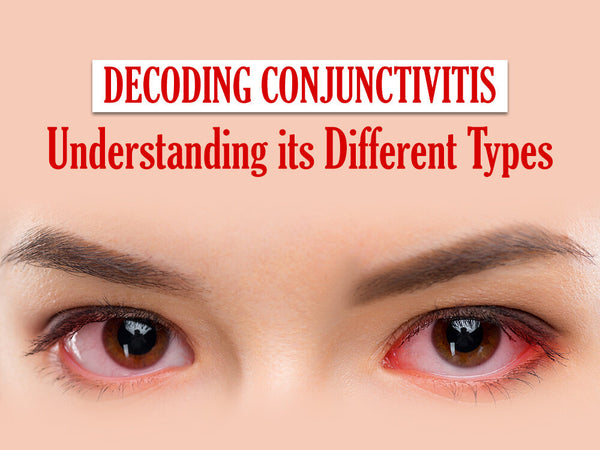 Understanding Types of Conjunctivitis