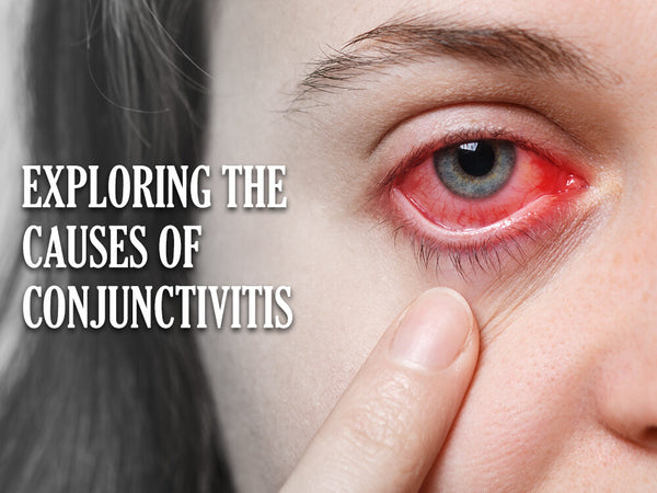 Causes Of Conjunctivitis Pink Eye