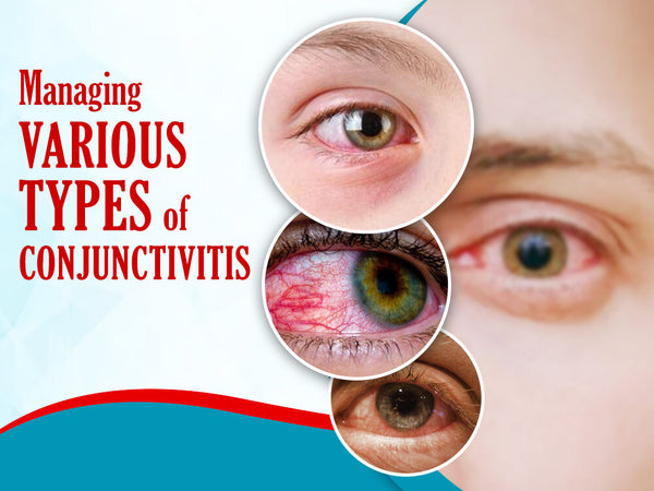 How to cure different types of conjunctivitis