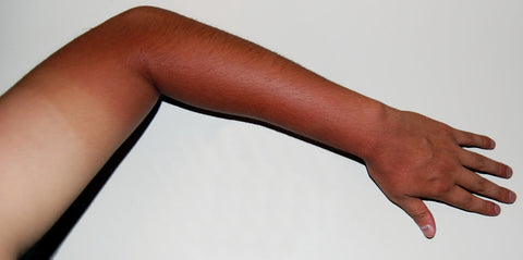sun tanned hands showing