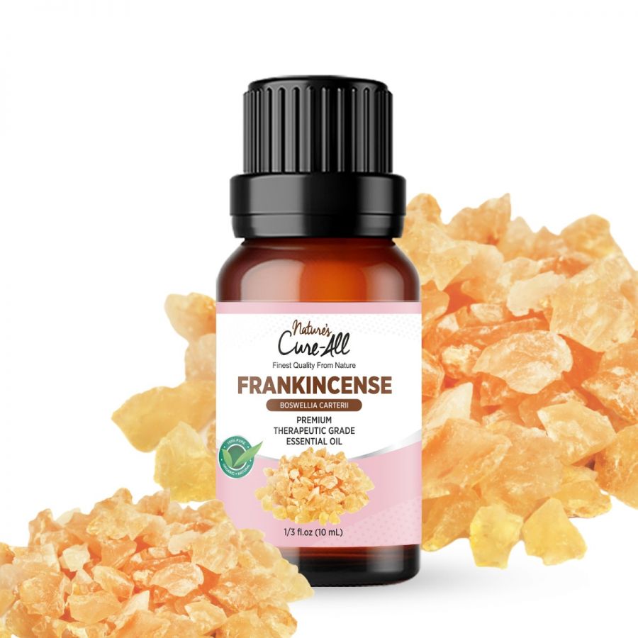 Frankincense Essential Oil