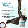 Dandruff Control Shampoo For All Hair Types - 300ml