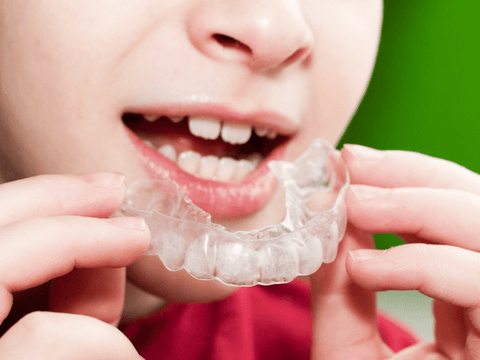 Best Way to Clean Your Mouth Guard, Night Guard or Retainer