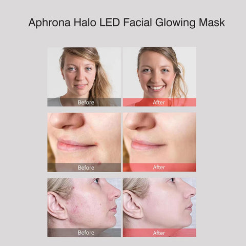 Experience Clinically Proven Results with Aphrona Halo LED Facial and Neck Mask. Notice Smoother Skin and Improved Acne in Just 4 Weeks. Elevate Your Skincare Journey Today