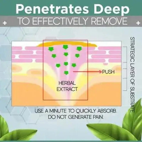 Effectively Removes Corn By Deep Penetration