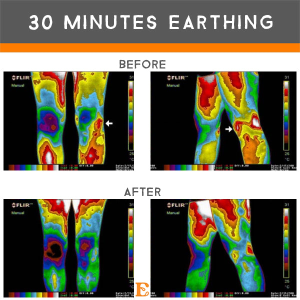 benefits 30 minutes earthing inflammation