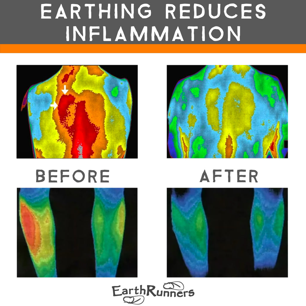 earthing lowers inflammation