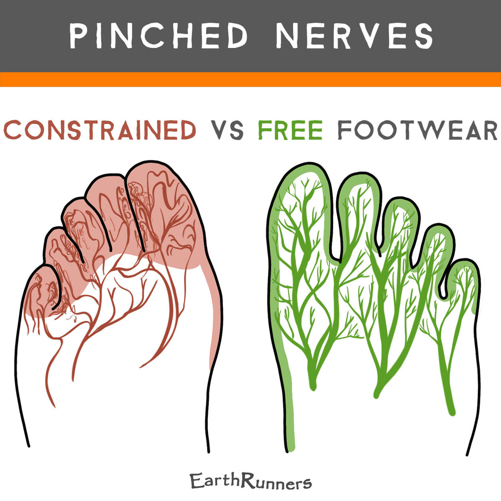shoes cause pinched nerves