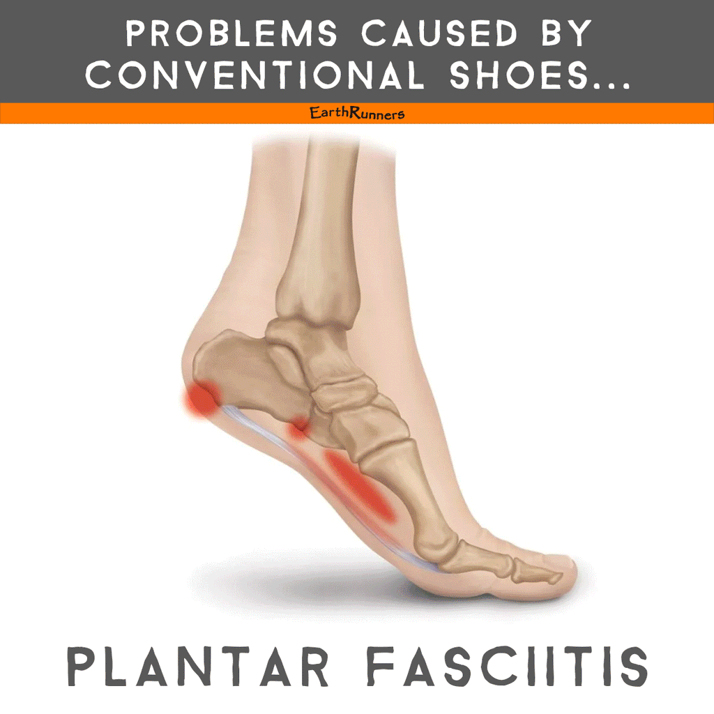 Are the Wrong Shoes Causing Your Heel Pain?: Hubert Lee, DPM: Podiatrist