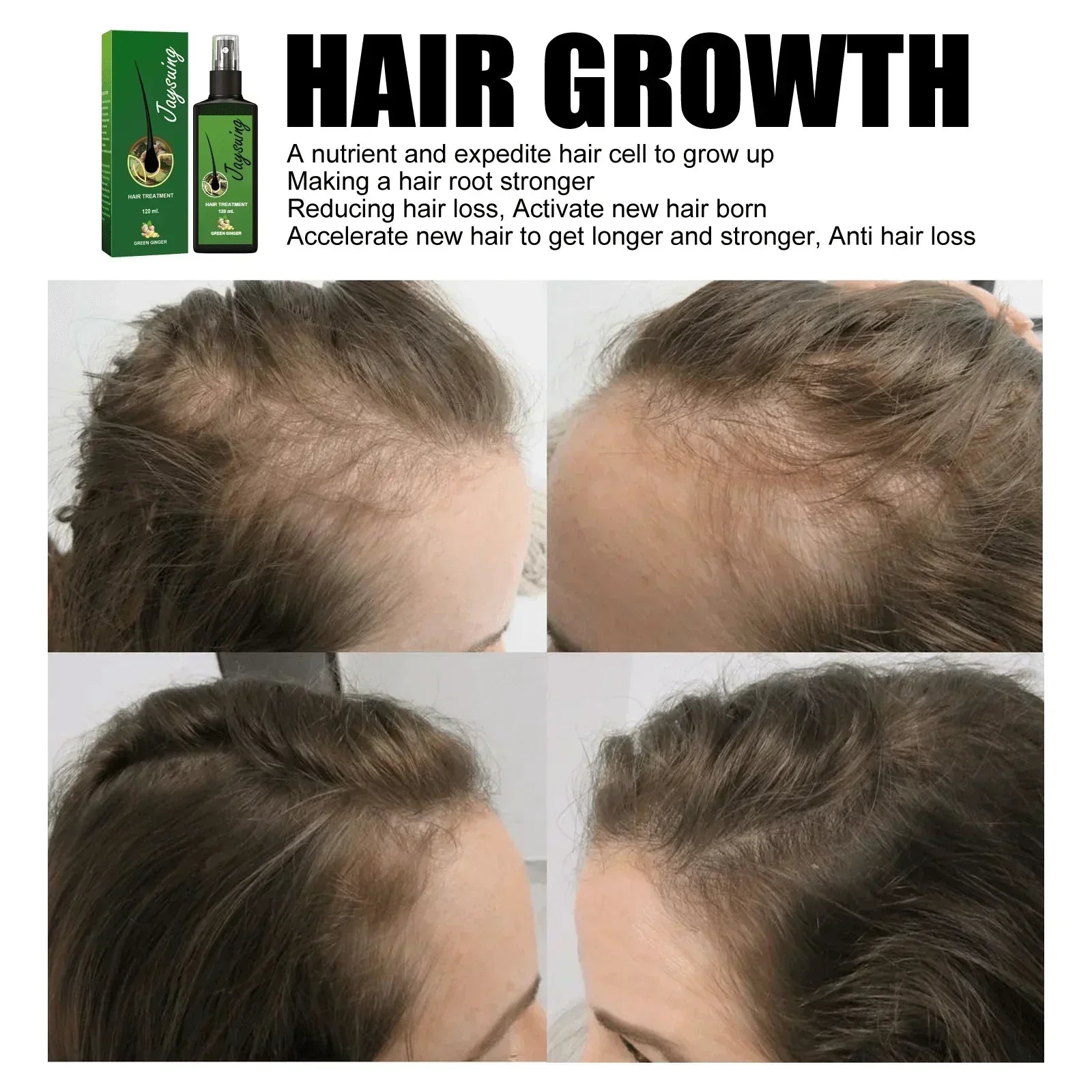 Jaysuing Hair Treatment, Strengthens Hair, Nourishes Root Growth And Thickens Scalp Massage Nutrient Solution - Evallys.com