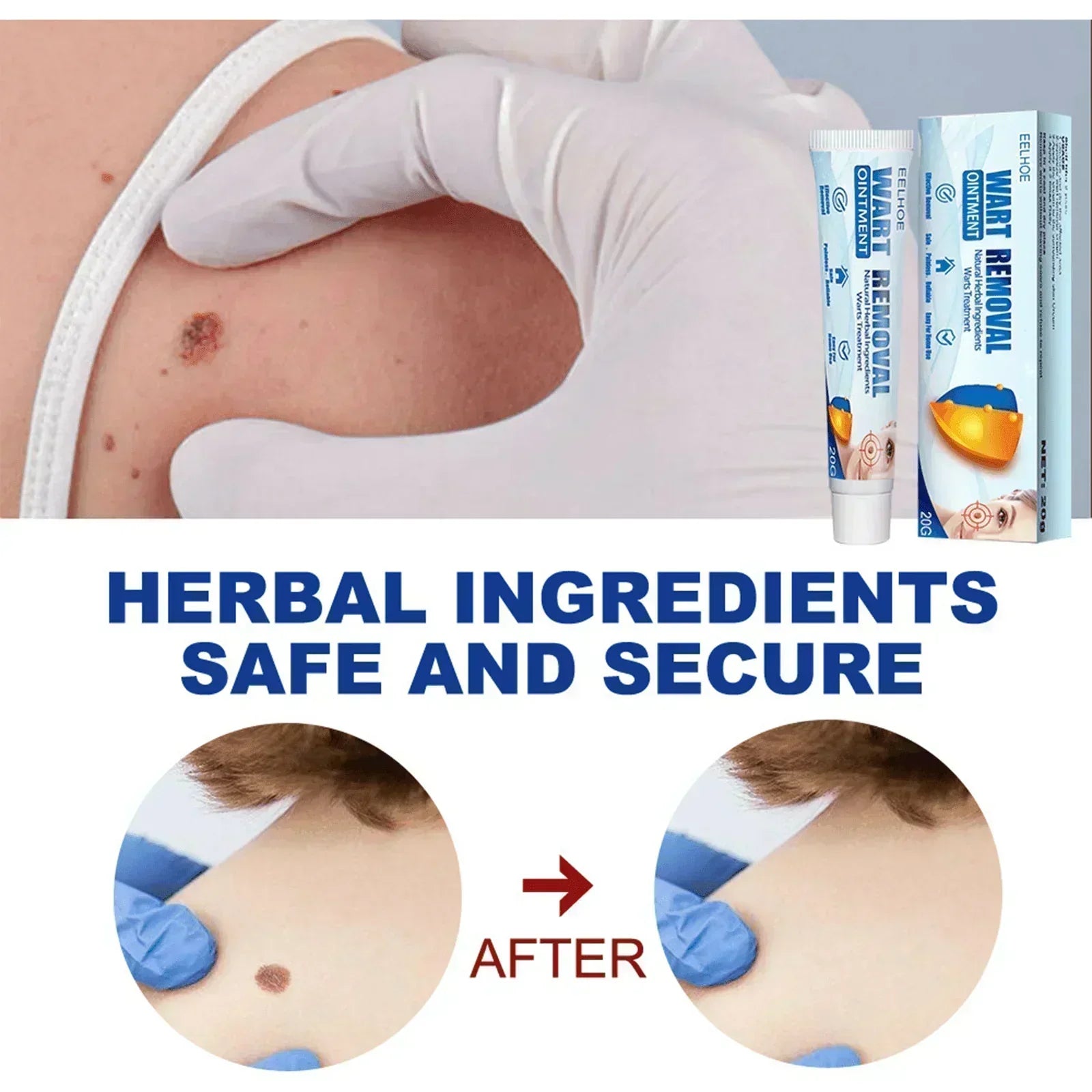 EELHOE Fragrance Removing Cream, Cleansing Skin Repair Care Body Face Removal Face Label Keyu Cream - Evallys.com