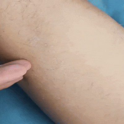 ÉPILATEUR CRISTAL pour toutes les sortes de peau