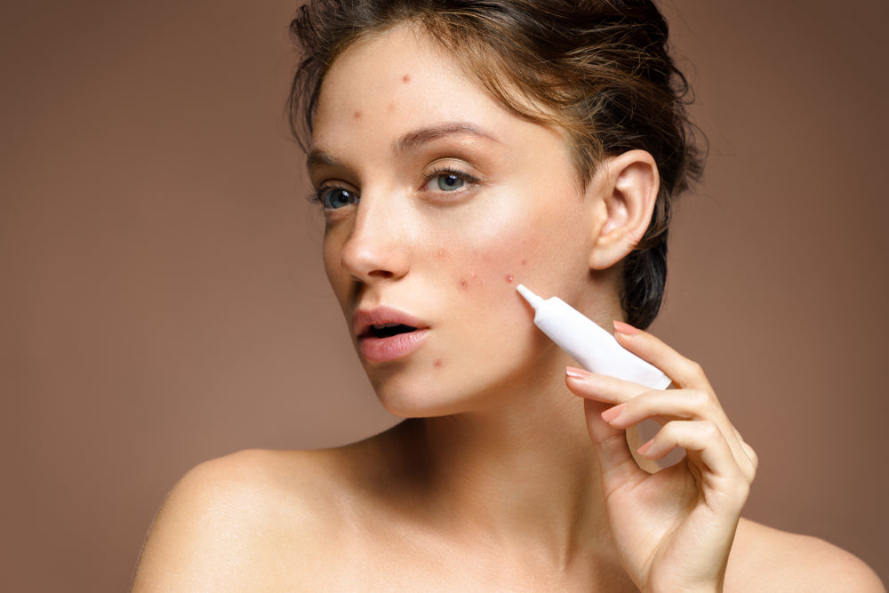Tips for Reducing the Risk of Skin Irritation