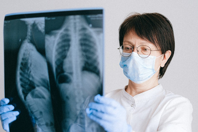 Doctor examining a lung x-ray