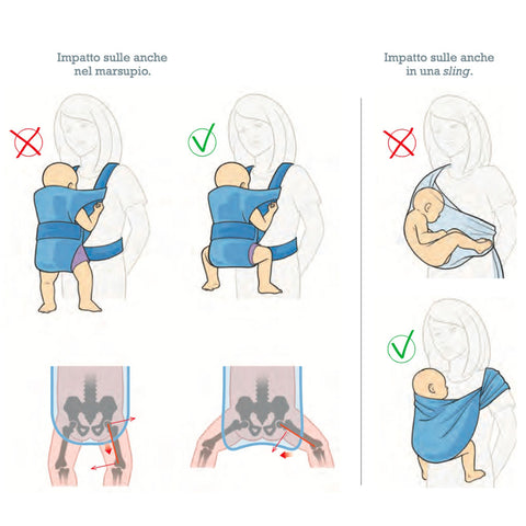 immagine dove vengono messe a confronto la posizione corretta delle anche con quella scoretta