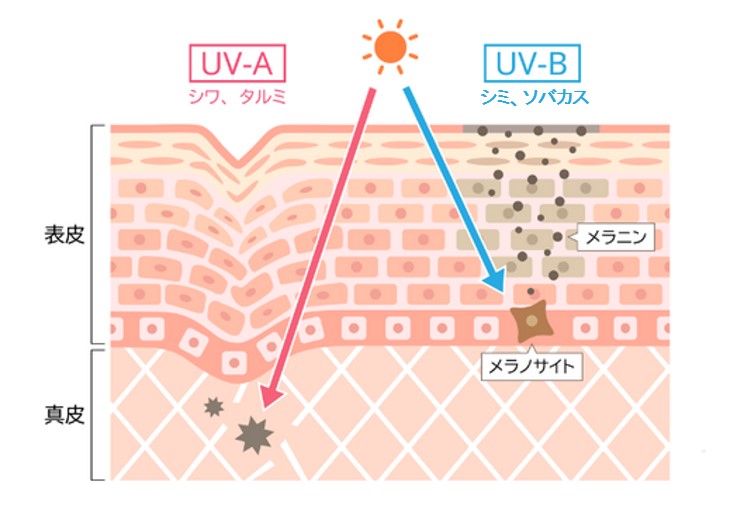 UVAとUVBの真皮への影響の違いを表した皮膚の画像