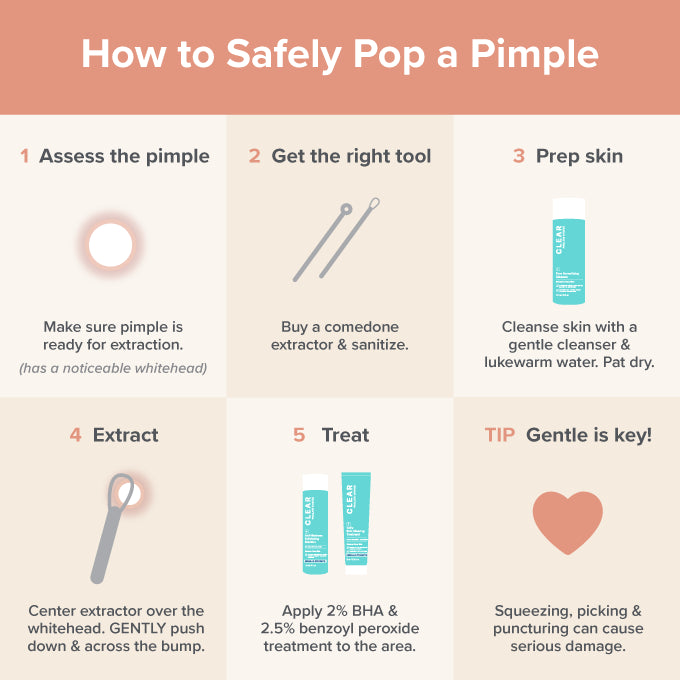 How To Safely Pop A Pimple