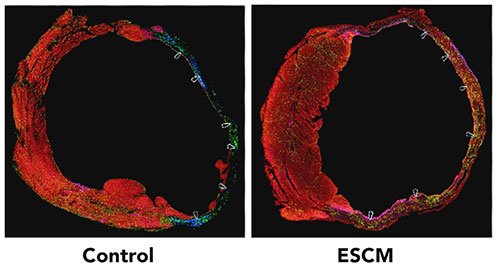 bone-marrow-stem-cells