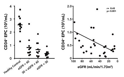 cd34-epc