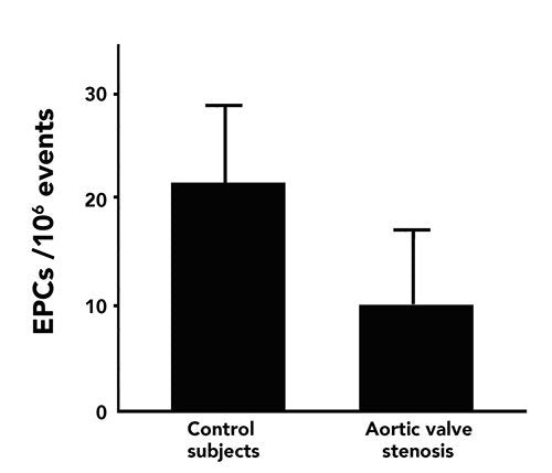 epcs