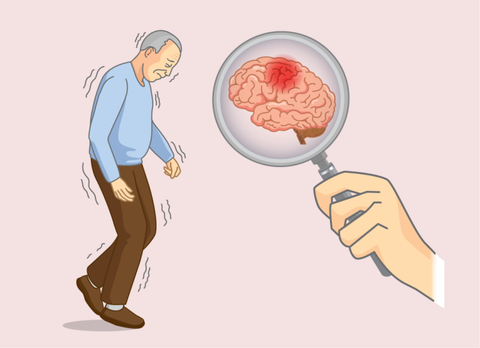 Alzheimer's Disease symtoms