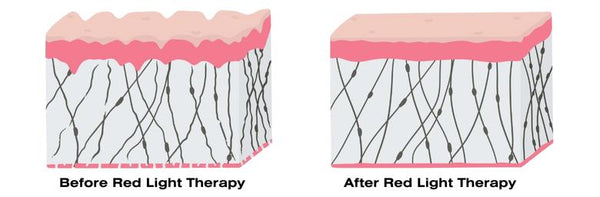 Before and After Red Light Therapy 