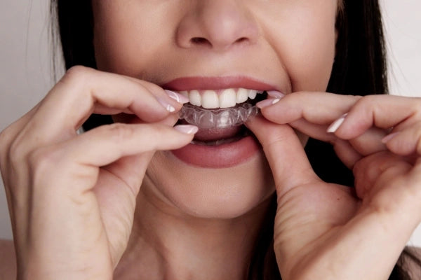 A woman putting on clear retainers