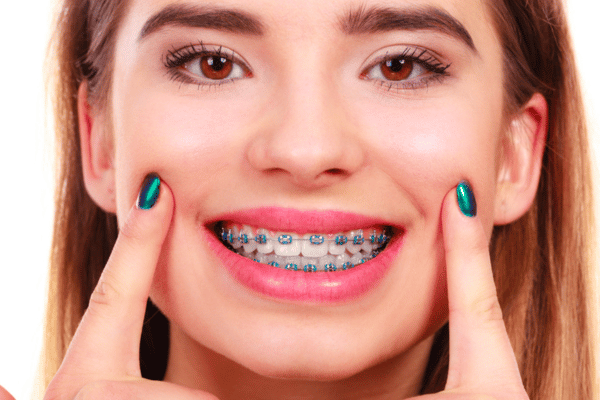 Woman with metal braces