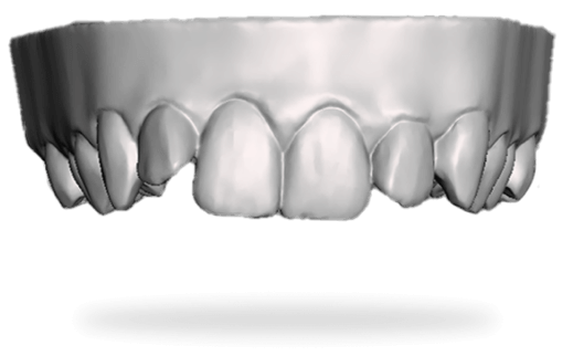 save-your-dental-impression.png__PID:2aa9b35c-35ef-4087-a421-0f8a616138b1