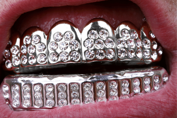 Close-Up of Teeth with Gold Grillz