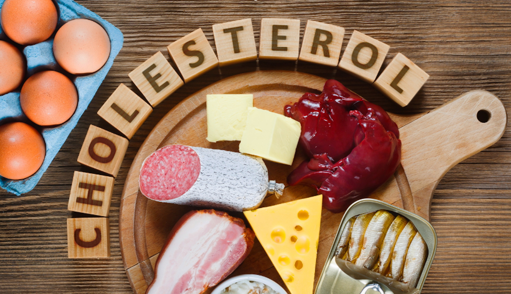 Porozumenie_cholesterolu_tipy_na_udrzanie_zdravej_hladiny