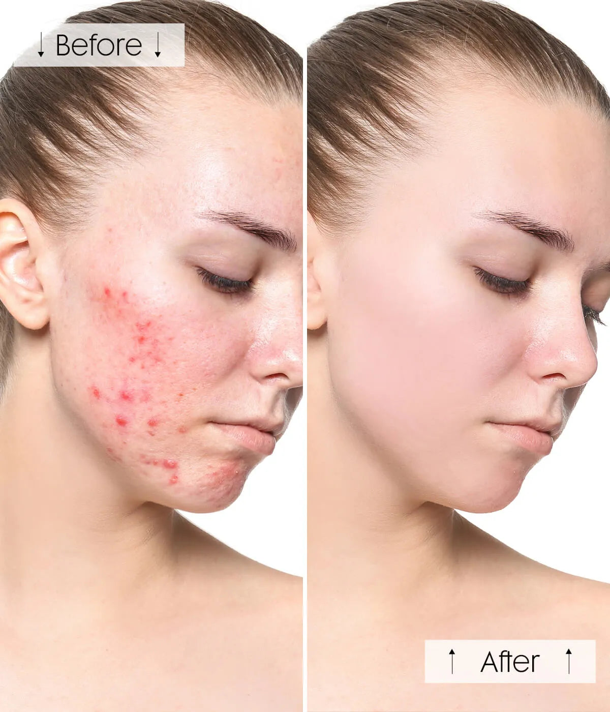 Boosts Skin Glow