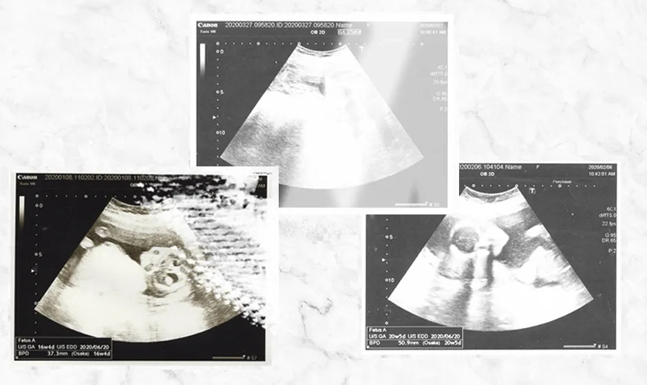 色褪せ具合が異なるエコー写真