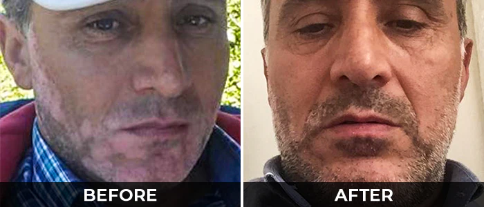 before-after-5.webp__PID:34414920-d5a3-458c-8dff-c454d995e64d